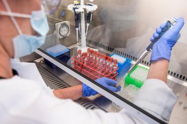 Samples of the University of Oxford coronavirus vaccine trials are handled at a laboratory. AP