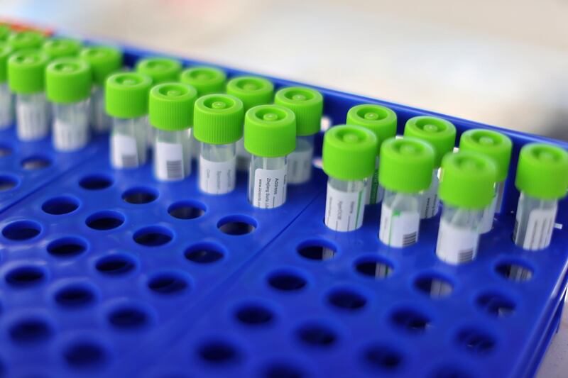 PCR coronavirus tests are seen at a testing site in Malibu, California, USA. Reuters