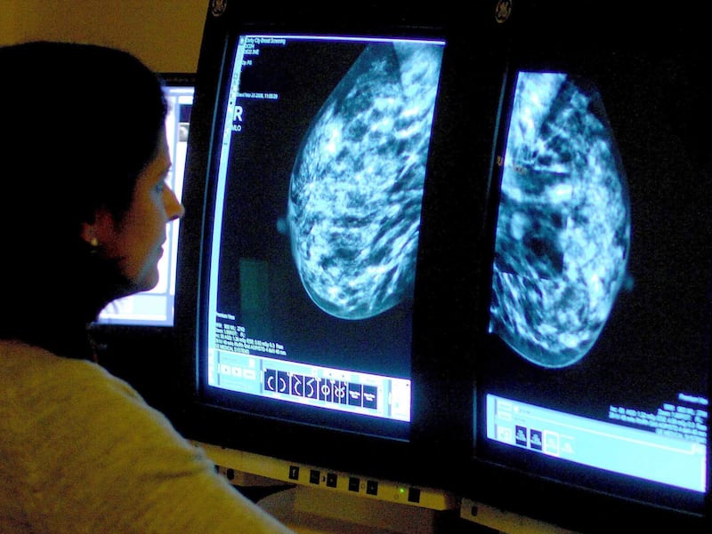 Doctors have urged women over the age of 40 to have a mammogram every year. PA