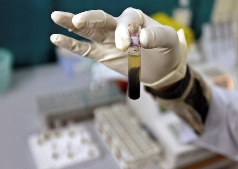 A laboratory assistant examines a blood sample inside a laboratory in the northeastern Indian city of Siliguri November 2, 2006. Faulty blood-testing kits for HIV and Hepatitis may have been fraudulently sold to government clinics across India, possibly resulting in people receiving transfusions of infected blood, officials said on Thursday. REUTERS/Rupak De Chowdhuri (INDIA) - GM1DTVVDDZAB