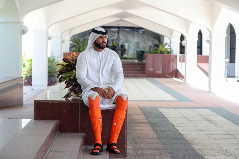 Dubai, United Arab Emirates - June 12th, 2018: Press conference hosted by the Dubai Health Authority on an Emirati double amputee Fahd Mohamad Ali who has received a set of 3D printed prosthetic legs. Tuesday, June 12th, 2018 DHA HQ, Dubai. Chris Whiteoak / The National