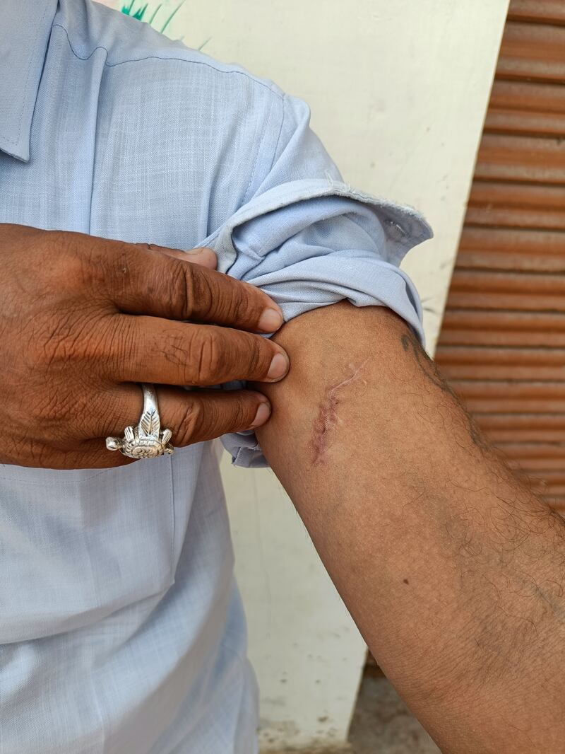 The tigress clawed Mr Saini’s left arm and injured his face, leaving him in hospital for days. His wounds took about two months to heal. Taniya Dutta / The National