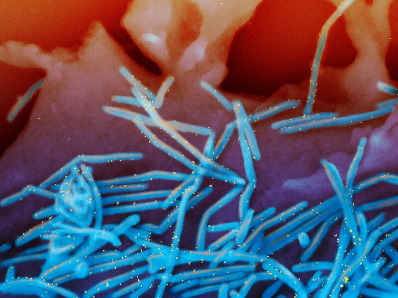 This electron microscope image from  the National Institutes of Health shows human respiratory syncytial virus virions, coloured blue. AP