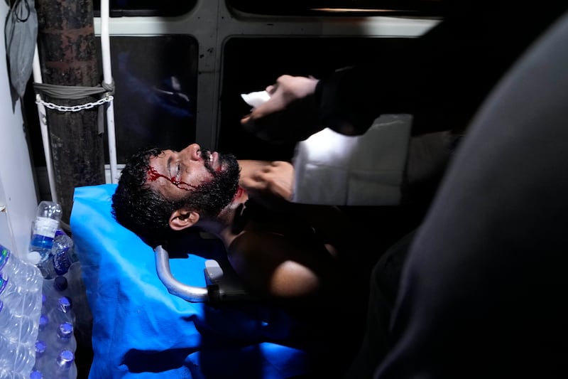 An injured protester lies in an ambulance after clashes with police near parliament in Colombo. AP