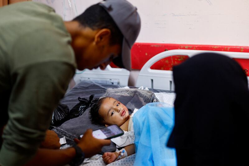 Wateen, a 14-month-old Palestinian baby, who was wounded in an Israeli strike that killed her mother and injured her twin brother Ahmed, recovers at Nasser hospital, in Khan Younis, Gaza Strip. Reuters