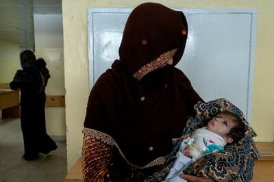 A mother and her baby at the malnutrition ward of the Indira Gandhi Hospital in Kabul. AP Photo