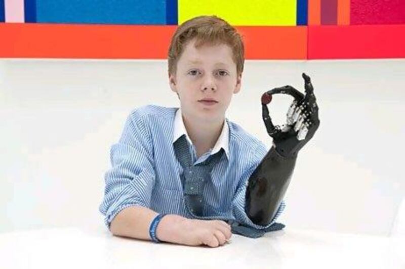 Patrick Kane, who was 13 when this photo was taken, was the youngest person in the world to be fitted with a Pulse prosthetic arm and hand. Matt Crossick for The National