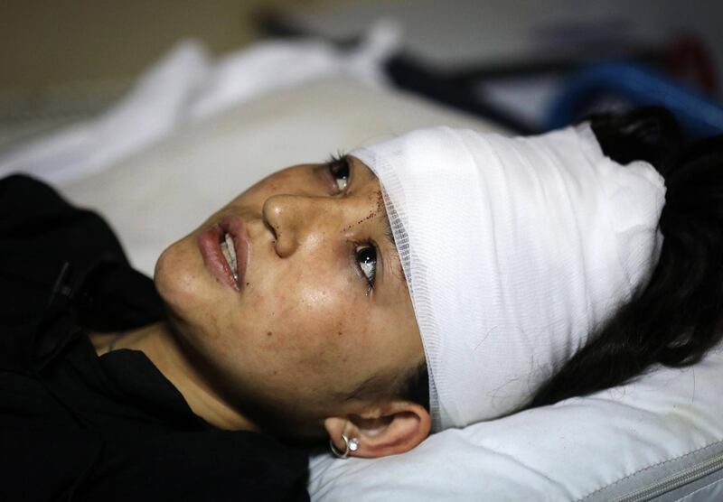 A student receives treatment at a hospital in Kabul after a explosions near a school in the west of the Afghan capital. EPA