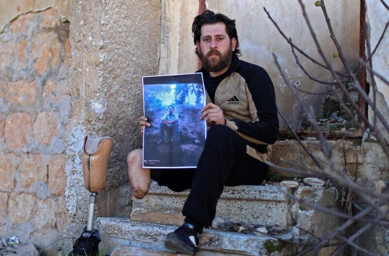 Bakri Al Debs, 29, a Syrian medic and amputee, poses for a picture in the town of Ihsim in Syria's rebel-held northwestern Idlib province on March 6, 2021, while holding a picture of himself in a similar pose from ten years prior at Tishrin University in Latakia where he studied Sociology, before losing his leg in a government air strike in 2015. AFP
