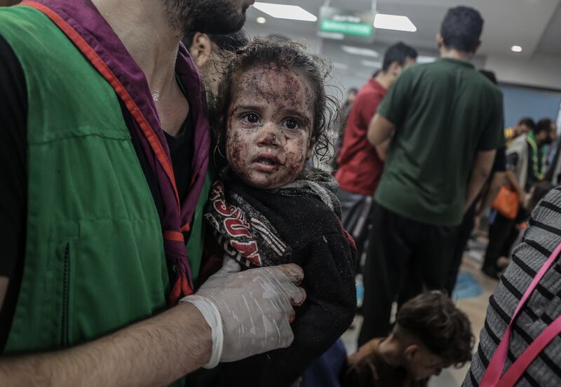 An injured child at Al Shifa Hospital after Israeli air strikes. A child is killed every 15 minutes in Gaza, Unicef's Middle East chief has said. Reuters