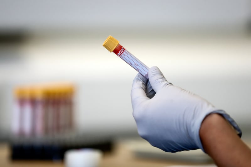 A new blood test has been developed to detect Alzheimer's disease. Press Association