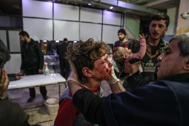Injured children are treated at a hospital in rebel-held Douma, Eastern Ghouta, Syria. Mohammed Badra / EPA