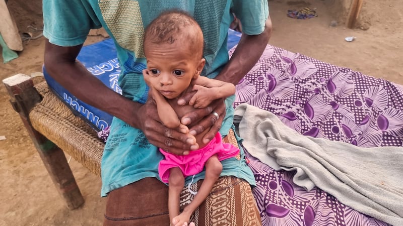 The father of malnourished boy Jiad Muhammad Jalal, 1, holds him at a camp for internally displaced people in Hajjah, Yemen. All photos: Reuters