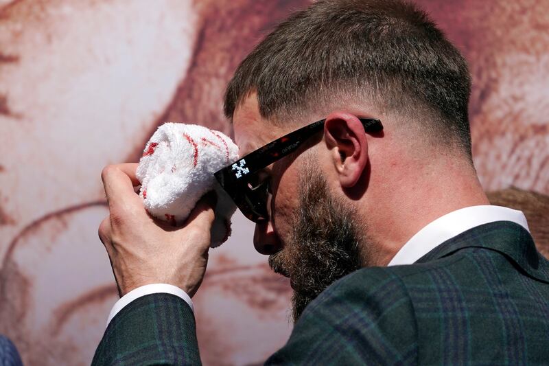 Caleb Plant wipes his head after being cut in a scuffle with unified Canelo Alvarez. AP
