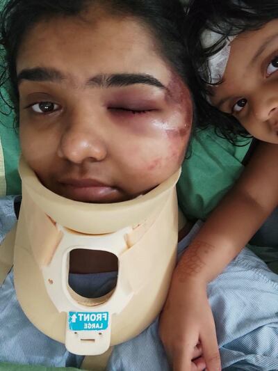 Mufeeda Kandy, 28, and her three-year-old daughter Laila Parambil. The mother and daughter are among 172 survivors of the Air India Express flight from Dubai to Kerala that crashed when it overshot the runway killing 18 on board. Photo taken at And from their hospital bed in Kozhikode. Courtesy Mufeeda Kandy