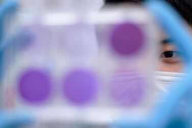 A researcher works on the diagnosis of suspected coronavirus Covid-19 cases in Brazil. AFP / Douglas MAGNO