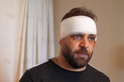 An injured man in hospital after Turkish shelling in Zakho. AFP