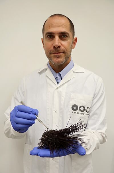 Dr Omri Bronstein of Tel Aviv University said healthy sea urchins become skeletons in a matter of days. Photo: Tel Aviv University