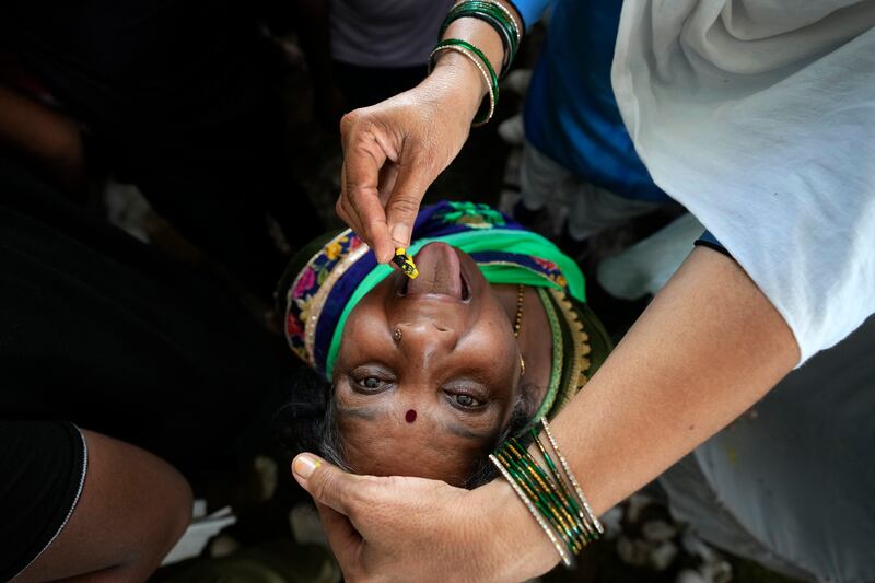 An asthma patient receives traditional 'fish medicine' in Hyderabad, India, from the Bathini Goud family, whose secret formula of herbs is handed down by generations. The herbs are inserted in the mouth of a live sardine and slipped into the patient's throat. AP Photo