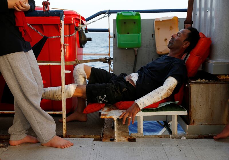 A Libyan man who suffered severe burns when he fought a fire on a boat carrying migrants waits off the coast of the island of Lampedusa for the Italian Coast Guard to take him for medical treatment.