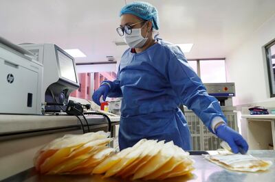 epa08597811 A nurse organizes samples of 'convalescent plasma' to treat patients with COVID-19, at the District Institute of Science, Biotechnology and Innovation in Health, in Bogota, Colombia, 11 August 2020. Colombian researchers working on a treatment with 'convalescent plasma' achieved encouraging results in a pilot study to treat patients with COVID-19.  EPA/Carlos Ortega