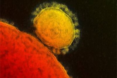 An electron microscope image of the Mers virus, a respiratory illness. New research suggests that a hybrid Mers-Covid virus could pose a major health threat. AP