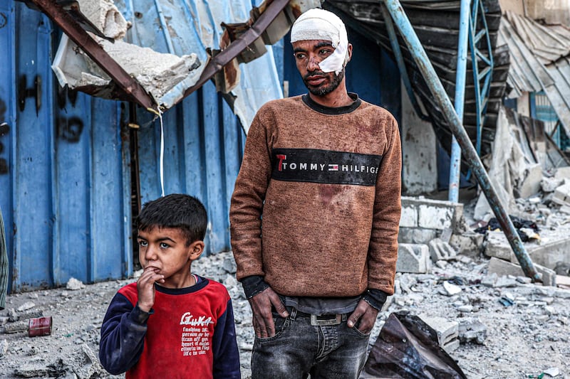 A wounded Palestinian man and a child stand by a destroyed building after Israeli bombardment in Rafah, in the south of the Gaza Strip. AFP