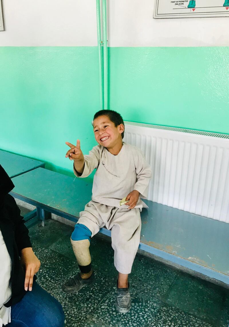 Five year old Afghan Sayeed Rahman smiles after receiving a new prosthetic leg in Kabul, on 7 May 2019. Ruchi Kumar / The National