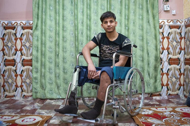 Jasim Abdulameer, 22, a former Iraqi Hashd Al Shaabi fighter, got injured during a military operation against the Islamic State. Amputee and jobless, Abdulameer lives now at his parent's house, in Basra, a major city in south Iraq. Photo by Sebastian Castelier