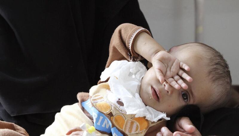 A woman holds her malnourished child at a therapeutic feeding center at Al Sabyeen hospital in Sanaa. Mohamed al-Sayaghi / Reuters