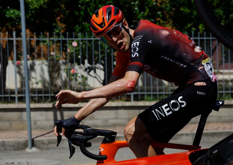 Ineos Grenadiers' Laurens de Plus with cuts and grazes after a crash during Stage 2. Reuters