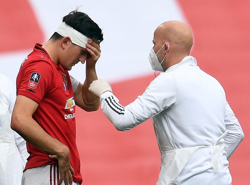 Manchester United's Harry Maguire after picking up a head injury. EPA