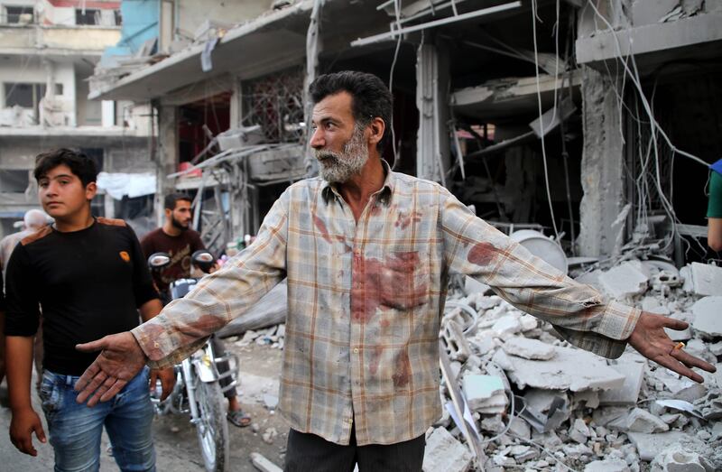 A Syrian man with a blood stained shirt gestures near debris following a reported Russian air strike in the district of Jisr al-Shughur, in the Idlib province, on September 25, 2017. 
Russian air strikes on northwest Syria's mainly jihadist-controlled province of Idlib killed at least 37 civilians including 12 children, a Britain-based monitor said. / AFP PHOTO / Mohamed al-Bakour