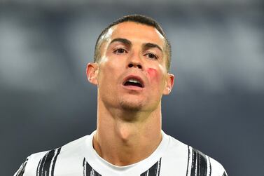 Juventus star Cristiano Ronaldo wearing red face paint to raise awareness of domestic violence against women Reuters