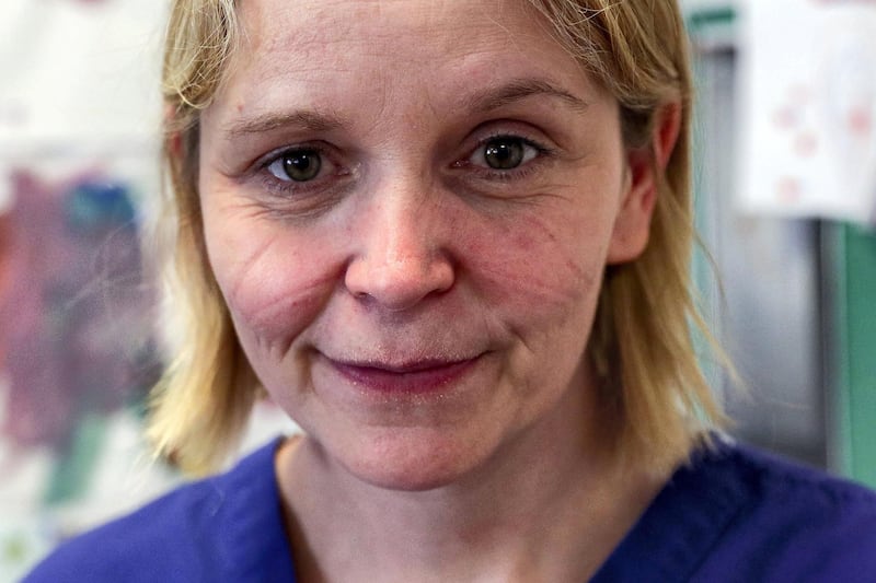 Marks made from wearing PPE (personal protective equipment) are pictured on the face of Nurse Susie Jewsbury, while working on an Intensive Care Unit ward at Frimley Park Hospital in Frimley, southwest England on May 22, 2020. - Britain's number of deaths "involving" the coronavirus has risen to 46,000, substantially higher than the 36,914 fatalities officially reported so far, according to a statistical update released Tuesday. (Photo by Steve Parsons / POOL / AFP)