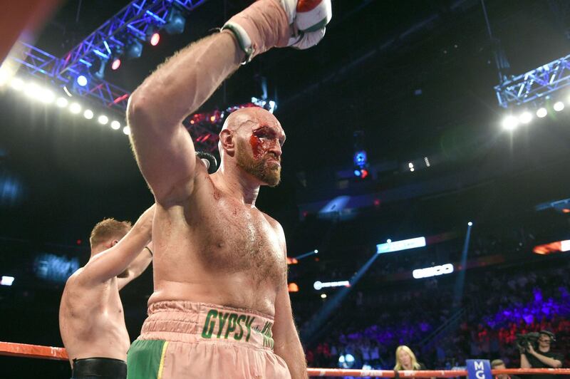 Tyson Fury reacts after the final bell in his heavy weight fight against Otto Wallin at T-Mobile Arena. AFP