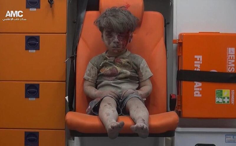 Omran Daqneesh, 5, sits inside an ambulance after being rescued from the rubble un the aftermath of an air raid on Aleppo. Aleppo Media Center via AP
