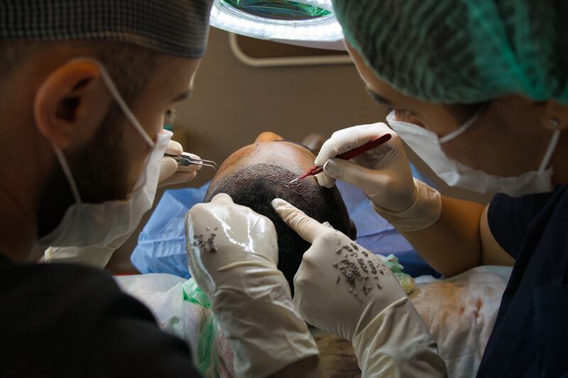 There are two types of hair transplant treatments, with costs typically starting at Dh10,000 in the UAE. Getty Images
