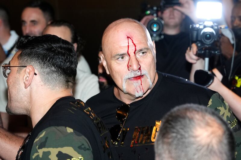 Blood pours down the face of John Fury following an altercation with a member of Oleksandr Usyk's team. PA