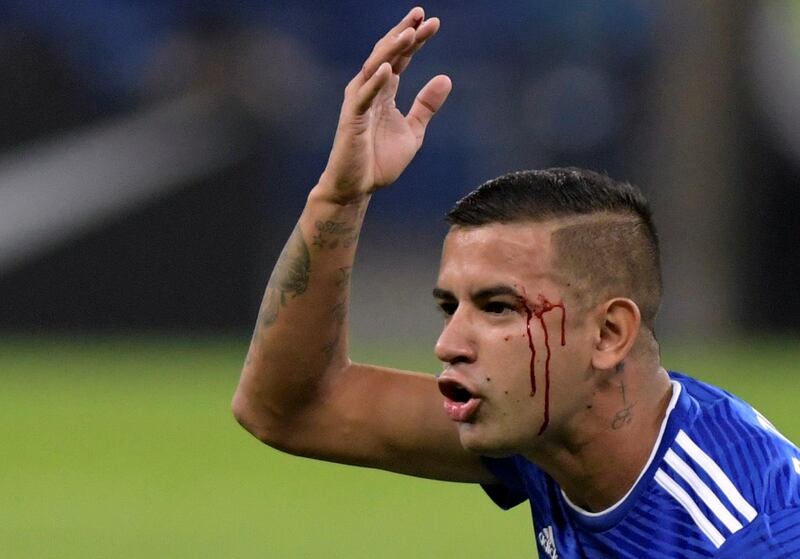 Paraguay's Derlis Gonzalez reacts after sustaining an injury. Reuters