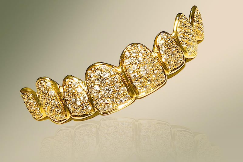 The world’s most expensive smile; diamond-encrusted gold dentures prices at Dh562,000. Courtesy Liberty Dental Clinic