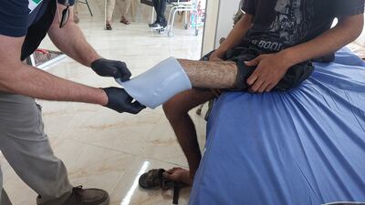 Patients are measured for their prosthetic limbs and receive training on how to use them. Photo: Mohammed Abu Amra