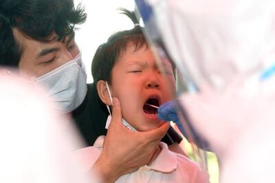 Saliva tests for Covid-19 are taken at the back of the throat. STR / AFP via Getty Images