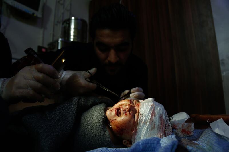 A Syrian child who was injured in shelling on the town of Misraba receives treatment at a make-shift hospital in the besieged rebel-held town of Douma, on the outskirts of the capital Damascus on early January 4, 2018.
At least 23 civilians were killed in the Syrian opposition redoubt of East Ghouta, near Damascus, with the majority of victims perishing in Russian air raids, a monitor said.  / AFP PHOTO / HASAN MOHAMED