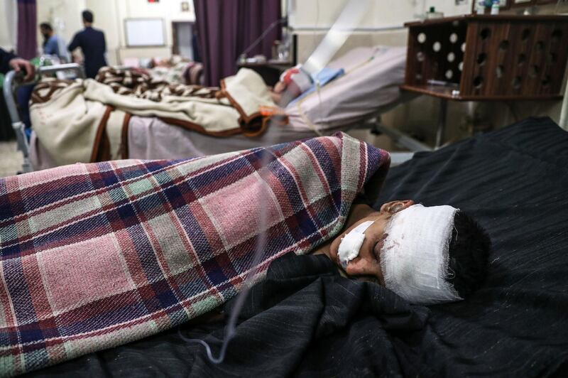 A injured boy is treated at a hospital in Douma after Syrian government bombing of the Eastern Ghouta region that killed at least 36 people on February 7, 2018. Mohammed Badra / EPA