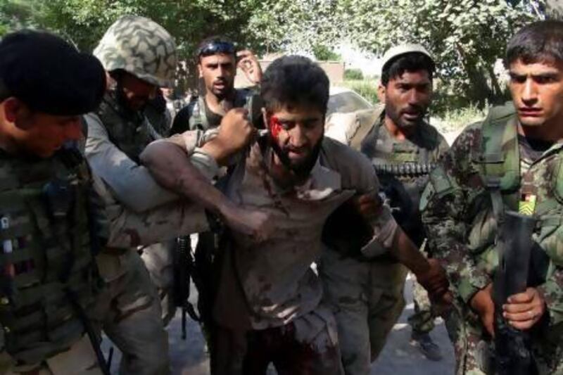 Afghan police carry an injured Taliban fighter, who was captured after an overnight clash with Afghan police in Jalalabad, in the eastern province of Nangrahar, east of Kabul.
