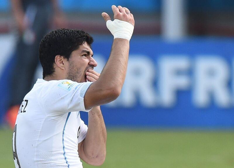 Luis Suarez gestures and puts his hand to his mouth after clashing with Italy's Giorgio Chiellini on Tuesday at the 2014 World Cup. It appeared that during a corner Luis Suarez jumped into Chiellini and, coming down, bit him on the shoulder. Javier Soriano / AFP / June 24, 2014