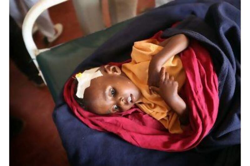 A refugee child lies in a hospital ward in the Ifo refugee camp, a part of the giant Dadaab refugee settlement in Kenya, close to the border with Somalia. Oli Scarff / Getty Images