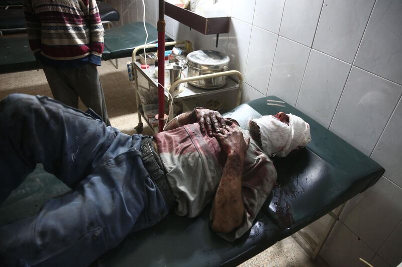 A wounded Syrian man waits to receive treatment at a make-shift hospital following Syrian government bombardments on the besieged rebel-held town of Hamouria in the eastern Ghouta on March 3, 2018. Abdulmonam Eassa / AFP