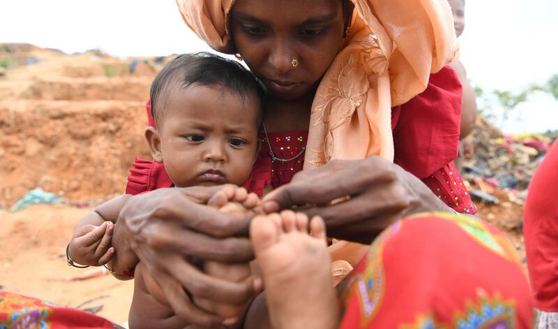 A Rohingya refugee mother uses a blade to cut the overgrown nails of her child at the Palangkhali refugee camp in Ukhia district on October 12, 2017.
Bangladesh has heavily curtailed access to the Rohingya camps in recent years, but eased restrictions last month after more than 520,000 new refugees poured across the border. The government's NGO Affairs Bureau approved 30 local and global aid groups to meet "emergency needs" in the overwhelmed camps, which already housed about 300,000 Rohingya before the latest influx.
 / AFP PHOTO / INDRANIL MUKHERJEE